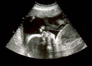 Sample 5 of added text - Sonagram